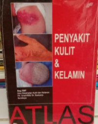 Image of PENYAKIT KULIT & KELAMIN - EDISI 2 - ATLAS